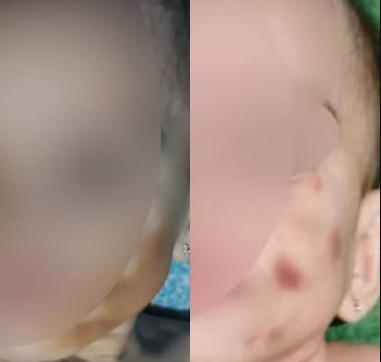 Mãe Presa por Maus-Tratos: O Uso de Maquiagem para Esconder Hematomas na Filha de 1 Ano