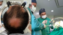 Brasileiro recebe chip cerebral para tratamento de TOC